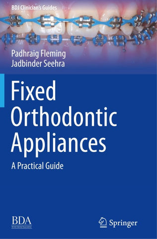 Fixed Orthodontic Appliances