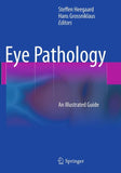 Eye Pathology