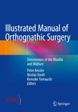 Illustrated Manual of Orthognathic Surgery
