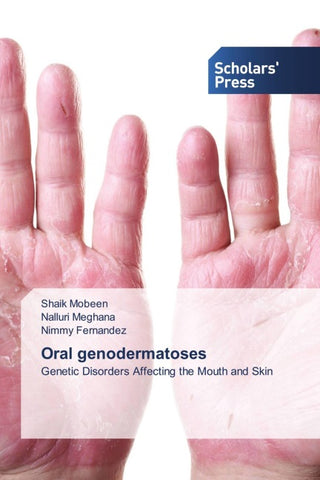 Oral genodermatoses