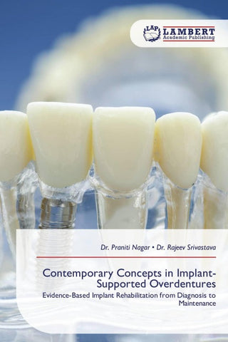 Contemporary Concepts in Implant-Supported Overdentures