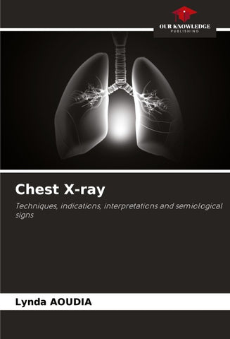 Chest X-ray