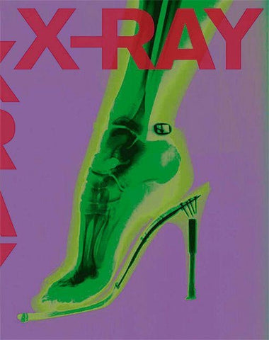 X-RAY