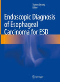 Endoscopic Diagnosis of Esophageal Carcinoma for ESD