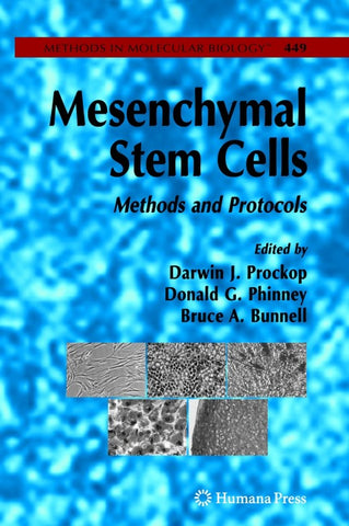 Mesenchymal Stem Cells