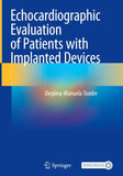 Echocardiographic Evaluation of Patients with Implanted Devices