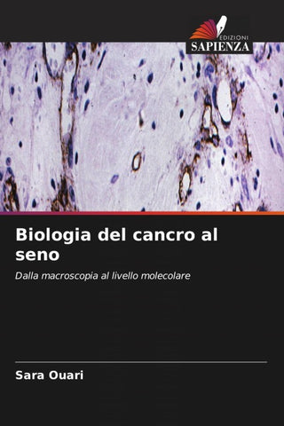 Biologia del cancro al seno