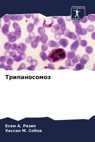 Tripanosomoz