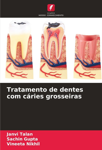 Tratamento de dentes com cáries grosseiras