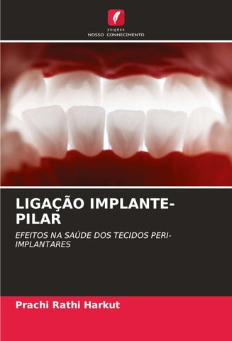 LIGAÇÃO IMPLANTE-PILAR