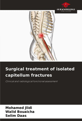 Surgical treatment of isolated capitellum fractures