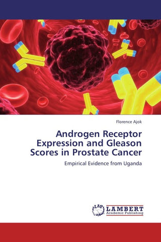 Androgen Receptor Expression and Gleason Scores in Prostate Cancer
