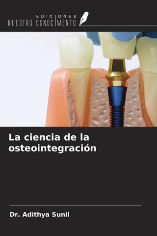 La ciencia de la osteointegración