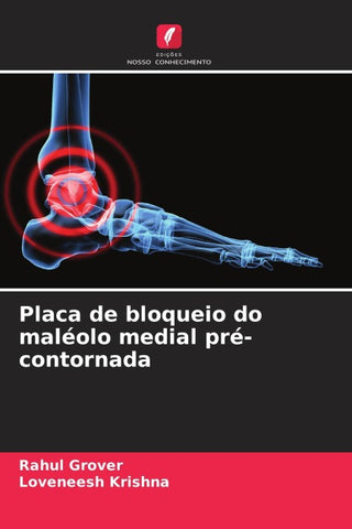Placa de bloqueio do maléolo medial pré-contornada