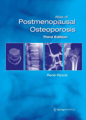 Atlas of Postmenopausal Osteoporosis
