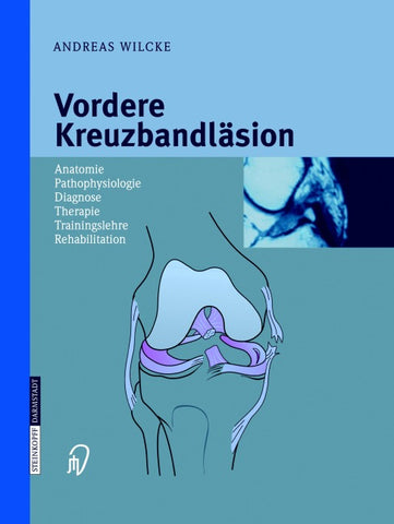 Vordere Kreuzbandläsion