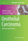 Urothelial Carcinoma