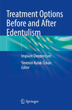 Treatment Options Before and After Edentulism
