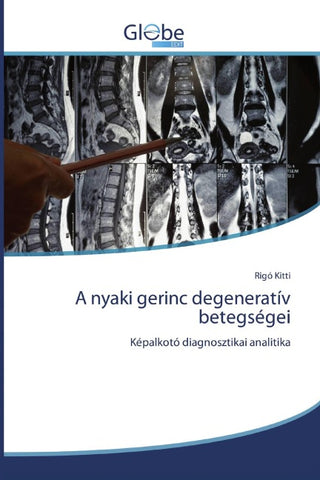 A nyaki gerinc degeneratív betegségei