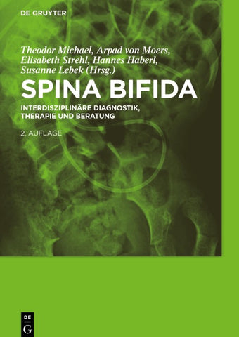 Spina bifida