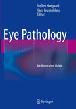 Eye Pathology