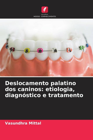 Deslocamento palatino dos caninos: etiologia, diagnóstico e tratamento