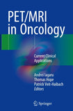 PET/MRI in Oncology