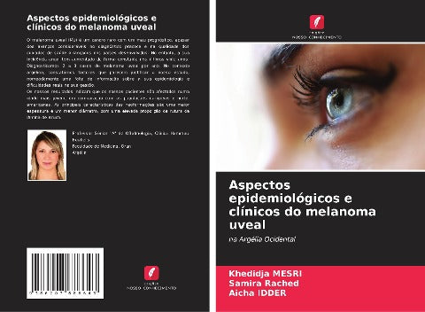 Aspectos epidemiológicos e clínicos do melanoma uveal