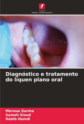 Diagnóstico e tratamento do líquen plano oral