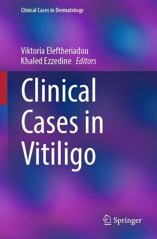 Clinical Cases in Vitiligo