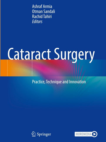 Cataract Surgery