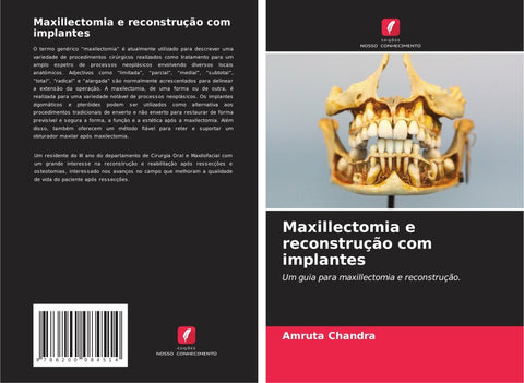 Maxillectomia e reconstrução com implantes