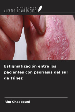 Estigmatización entre los pacientes con psoriasis del sur de Túnez