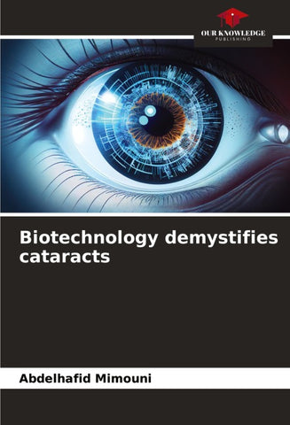 Biotechnology demystifies cataracts