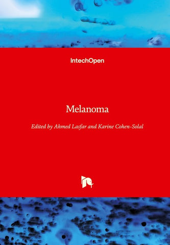 Melanoma