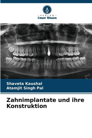 Zahnimplantate und ihre Konstruktion