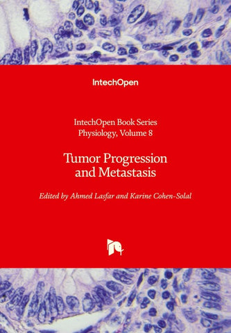 Tumor Progression and Metastasis