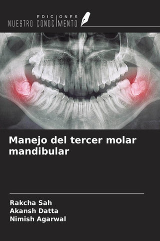 Manejo del tercer molar mandibular
