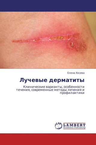 Luchewye dermatity