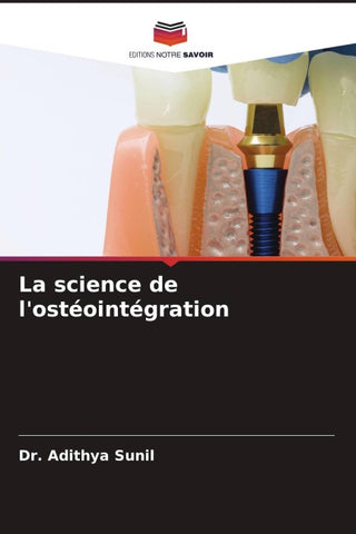 La science de l'ostéointégration
