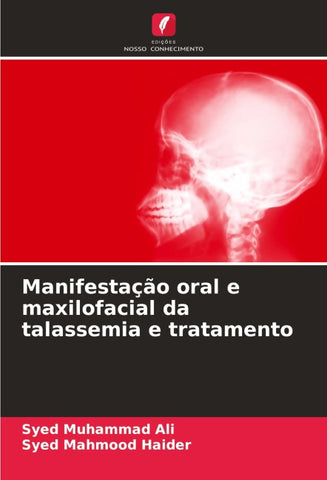 Manifestação oral e maxilofacial da talassemia e tratamento