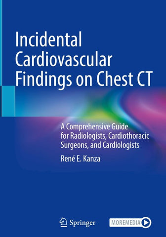 Incidental Cardiovascular Findings on Chest CT