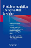 Photobiomodulation Therapy in Oral Medicine