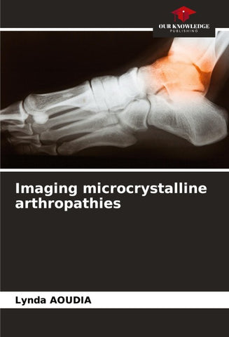 Imaging microcrystalline arthropathies