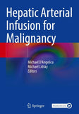 Hepatic Arterial Infusion for Malignancy