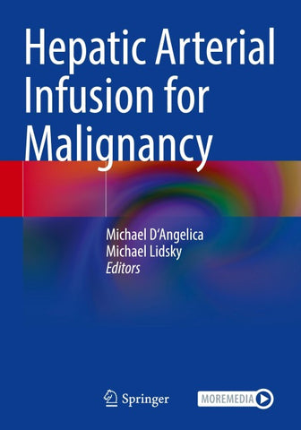 Hepatic Arterial Infusion for Malignancy