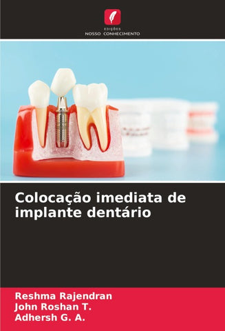 Colocação imediata de implante dentário