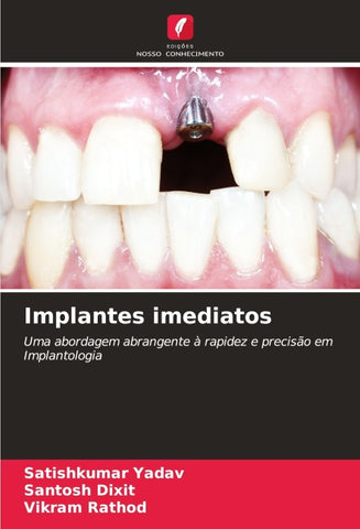 Implantes imediatos