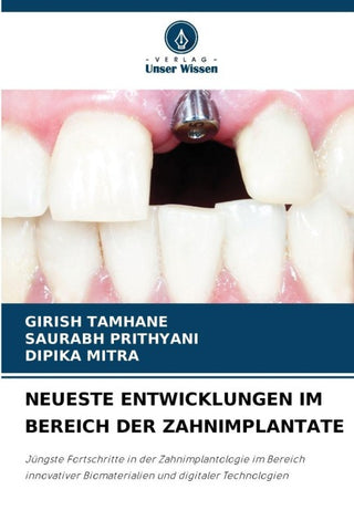 NEUESTE ENTWICKLUNGEN IM BEREICH DER ZAHNIMPLANTATE