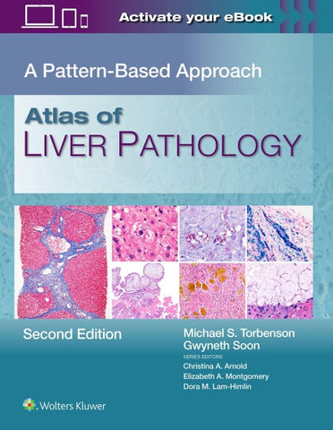 Atlas of Liver Pathology